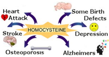 Graphic: High Homocysteine is linked to cardiovascular disease, stroke, osteoporosis, Alzheimer's, Depression, and even some birth defects in babies whose mothers had a high homocysteine level during pregnancy