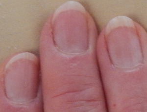 Picture of fingernails showing small moons returning from eating Swiss cheese