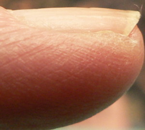 photo - normal fingernail, little finger left hand