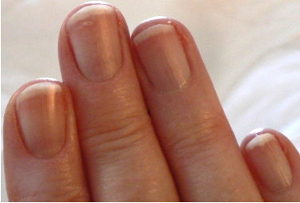 moons on fingernails reappear following less stress