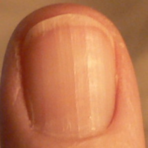 Ridges on thumbnail, indistinct moon