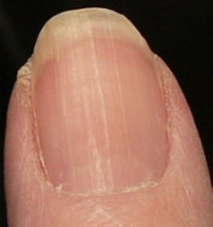 Fingernail with fewer ridges toward the bottom 