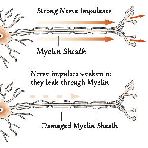 To have strong Nerve Impulses you need a healthy Myelin Sheath