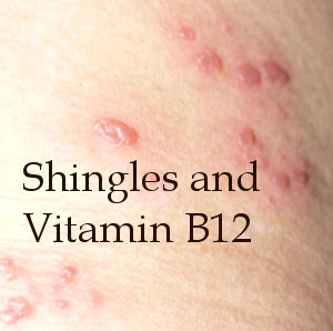 Photo of shingles fever blisters; Text: Shingles and Vitamin B12