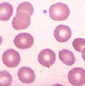 healthy blood cells