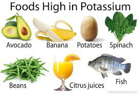 Graphic showing foods high in potassium - avocado, banana, potato, spinach, beans, citrus, fish