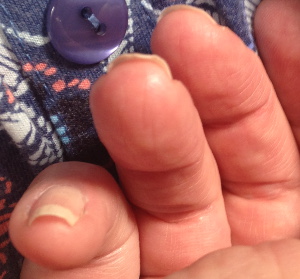 Bending Fingernail Warning just beginning to exist Bending Fingernail Warning just beginning to exist