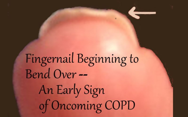 Bending Fingernail Warning · Health Boundaries