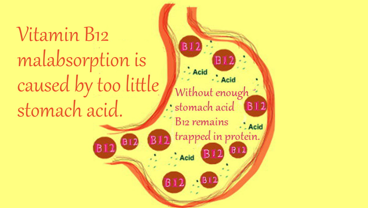 Vitamin B12 Malabsorption