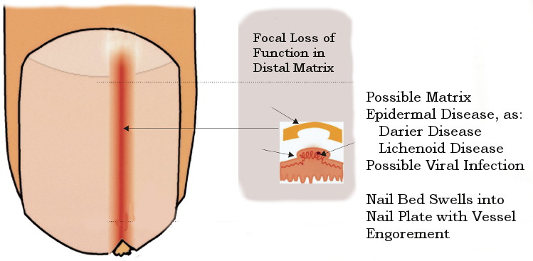 redness-under-fingernails-health-boundaries